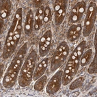 Anti-C1orf109 Antibody