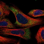 Immunofluorescent staining of human cell line U-2 OS shows localization to cytosol.