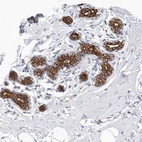 Immunohistochemical staining of human breast shows moderate to strong cytoplasmic and membranous positivity in glandular cells.