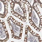 Immunohistochemical staining of human gastrointestinal shows moderate to strong cytoplasmic and membranous positivity in glandular cells.