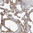 Immunohistochemical staining of human lung shows moderate to strong cytoplasmic and membranous positivity in pneumocytes.