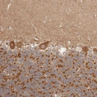 Immunohistochemical staining of human cerebellum shows moderate cytoplasmic positivity in Purkinje cells.
