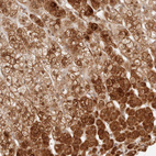 Immunohistochemical staining of human adrenal gland shows moderate to strong cytoplasmic positivity in glandular cells.