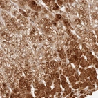 Immunohistochemical staining of human adrenal gland shows moderate to strong cytoplasmic positivity in glandular cells.