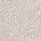 Immunohistochemical staining of human liver shows only very weak cytoplasmic positivity in hepatocytes.