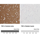 Anti-TNR Antibody