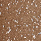 Immunohistochemical staining of human cerebral cortex shows strong cytoplasmic positivity in neuropil.