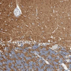 Immunohistochemical staining of human cerebellum shows strong cytoplasmic positivity in neuropil.