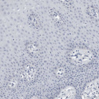 Immunohistochemical staining of human cervix, uterine shows no positivity in squamous epithelial cells as expected.