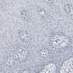 Immunohistochemical staining of human cervix, uterine shows no positivity in squamous epithelial cells as expected.