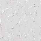 Immunohistochemical staining of human skeletal muscle shows no positivity in myocytes as expected.