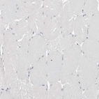 Immunohistochemical staining of human skeletal muscle shows no positivity in myocytes as expected.