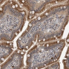 Immunohistochemical staining of human Duodenum shows strong granular cytoplasmic positivity in glandular cells.