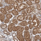 Immunohistochemical staining of human Kidney shows strong granular cytoplasmic positivity in cells in tubules.