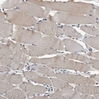 Immunohistochemical staining of human Skeletal muscle shows very weak cytoplasmic positivity in myocytes.
