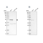 Western blot analysis using Anti-SCP2 antibody HPA027135 (A) shows similar pattern to independent antibody HPA027317 (B).