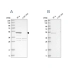 Western blot analysis using Anti-SCP2 antibody HPA027135 (A) shows similar pattern to independent antibody HPA027317 (B).