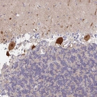 Anti-AMPD2 Antibody