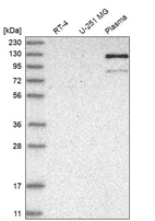 Western blot analysis in human cell line RT-4, human cell line U-251 MG and human plasma.