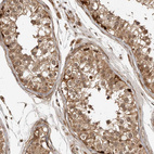 Immunohistochemical staining of human testis shows moderate cytoplasmic and nuclear positivity in cells in seminiferous ducts.