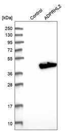 Western blot analysis in control (vector only transfected HEK293T lysate) and ADPRHL2 over-expression lysate (Co-expressed with a C-terminal myc-DDK tag (~3.1 kDa) in mammalian HEK293T cells, LY402619).
