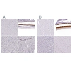 Anti-IMPG1 Antibody