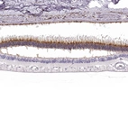 Immunohistochemical staining of human eye, retina using Anti-IMPG1 antibody HPA027142.