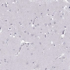 Immunohistochemical staining of human cerebral cortex shows no positivity in neurons as expected.
