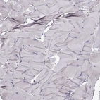 Immunohistochemical staining of human skeletal muscle shows no positivity in myocytes as expected.