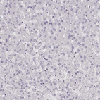 Anti-IMPG1 Antibody