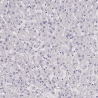 Immunohistochemical staining of human liver shows no positivity in hepatocytes as expected.
