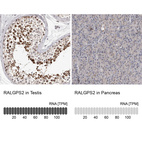 Anti-RALGPS2 Antibody