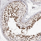 Immunohistochemical staining of human testis shows high expression.