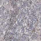 Immunohistochemical staining of human lymph node using Anti-RALGPS2 antibody HPA027143.