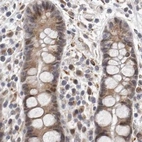 Immunohistochemical staining of human colon using Anti-RALGPS2 antibody HPA027143.