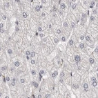 Immunohistochemical staining of human liver using Anti-RALGPS2 antibody HPA027143.