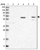 Lane 1: Marker [kDa] 230, 130, 95, 72, 56, 36, 28, 17, 11_br/_Lane 2: Human cell line RT-4_br/_Lane 3: Human cell line U-251MG sp_br/_Lane 4: Human plasma (IgG/HSA depleted)_br/_Lane 5: Human liver tissue_br/_Lane 6: Human tonsil tissue
