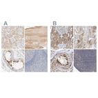 Immunohistochemical staining of human kidney, skeletal muscle, testis and tonsil using Anti-SPATA20 antibody HPA027144 (A) shows similar protein distribution across tissues to independent antibody HPA031442 (B).
