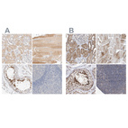 Anti-SPATA20 Antibody