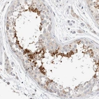 Immunohistochemical staining of human testis shows strong cytoplasmic positivity in spermatids.