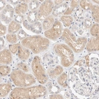 Immunohistochemical staining of human kidney shows moderate cytoplasmic positivity in cells in tubules.