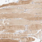 Immunohistochemical staining of human skeletal muscle shows moderate cytoplasmic positivity in myocytes.