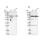 Western blot analysis using Anti-SPATA20 antibody HPA027144 (A) shows similar pattern to independent antibody HPA022023 (B).
