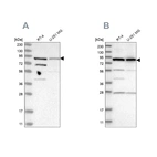 Western blot analysis using Anti-SPATA20 antibody HPA027144 (A) shows similar pattern to independent antibody HPA022023 (B).