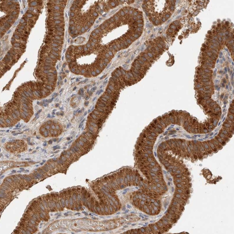 Anti-SGK3 Antibody