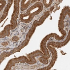 Anti-SGK3 Antibody