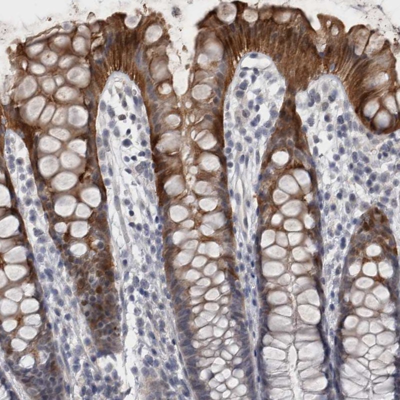 Anti-IFI44 Antibody