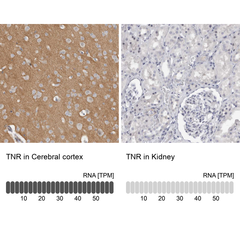 Anti-TNR Antibody