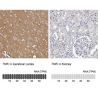 Anti-TNR Antibody
