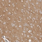 Immunohistochemical staining of human cerebral cortex shows high expression.